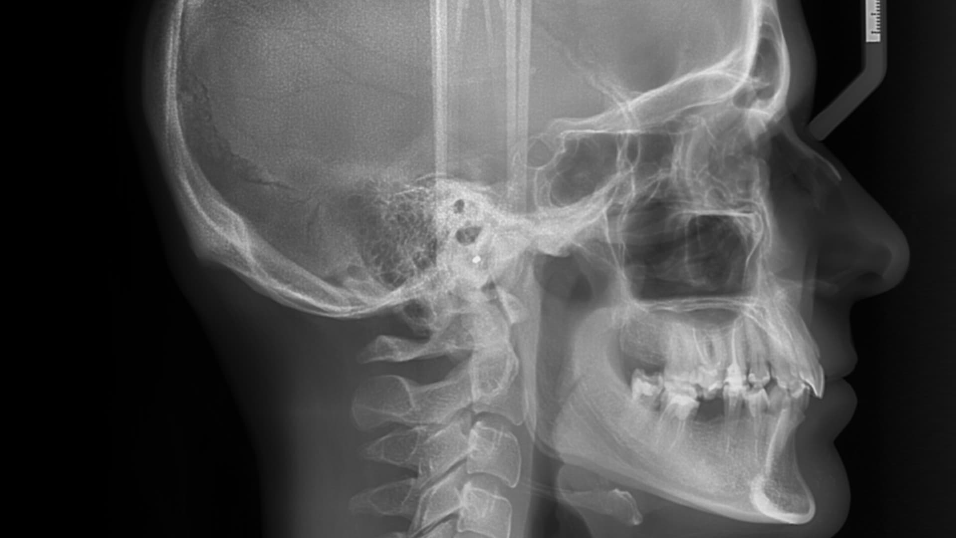 Tomografía dental 3D Odontokinética