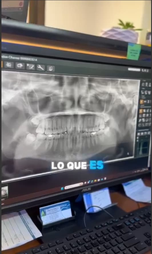 El proceso de tu radiografía