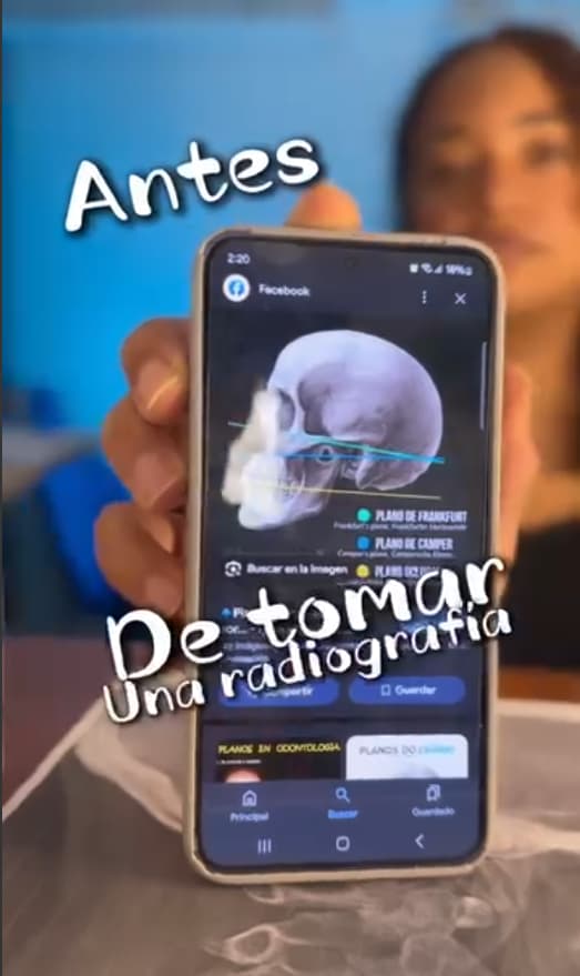 Posición para una radiografía de calidad